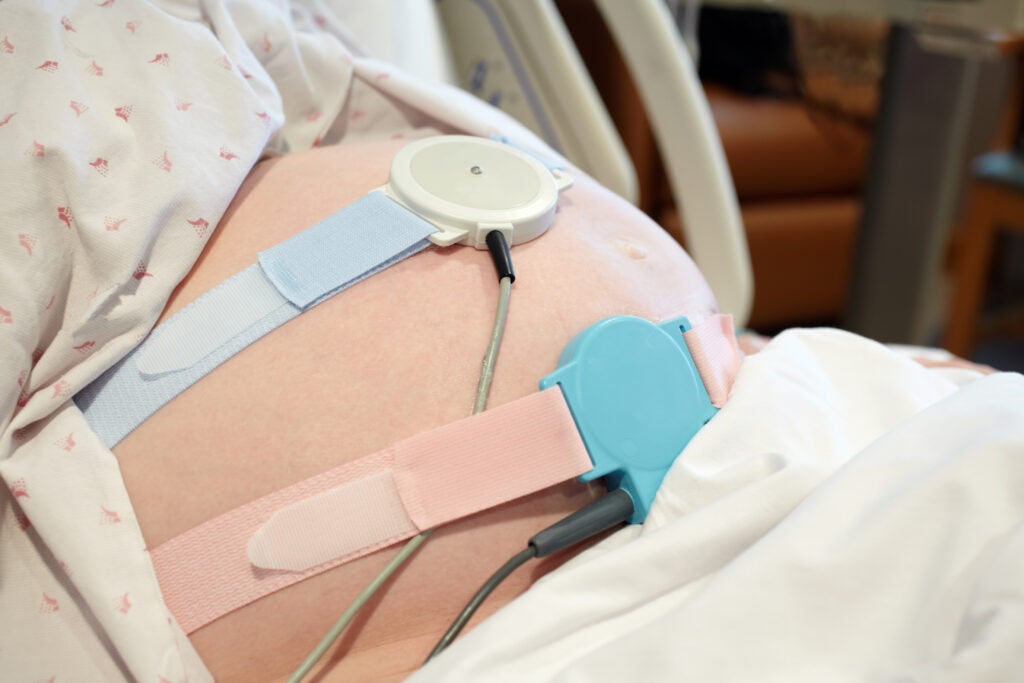 Picture of pregnant person's belly with electronic fetal monitoring devices attached to it. 